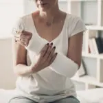 woman in an arm cast