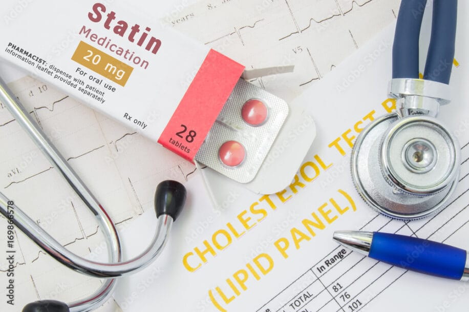 Men Who Take Statins May Exercise Less