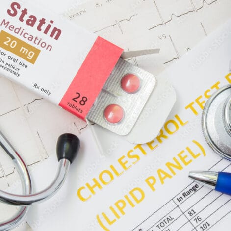 Do Statins Up a Woman’s Risk for Thyroid Cancer?