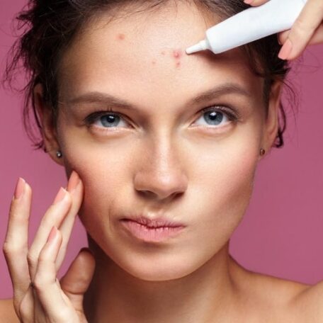 Side Effects of Acne Medicines
