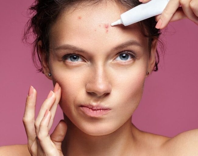 Side Effects of Acne Medicines