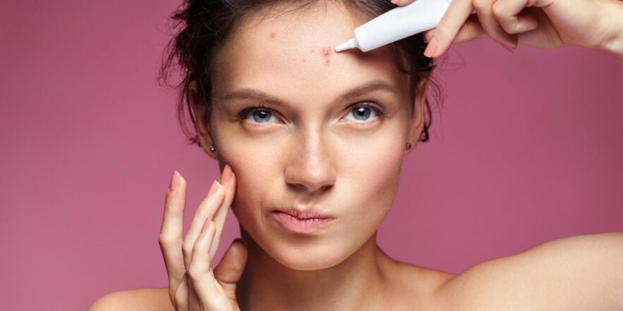 Side Effects of Acne Medicines