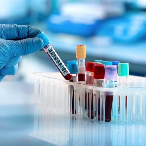 Too Many Diagnostic Tests?