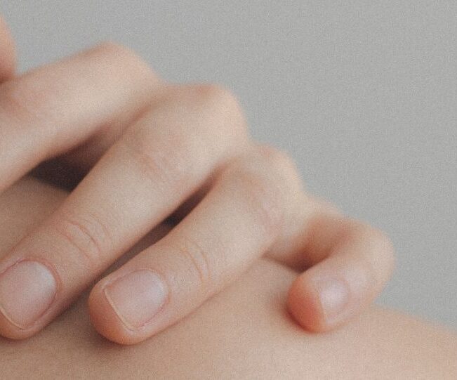 5 Common Drug Reactions That Affect the Skin