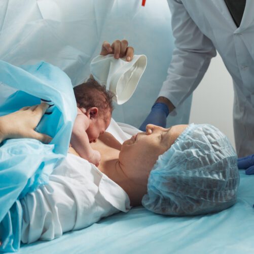 Is That C-Section Really Necessary?
