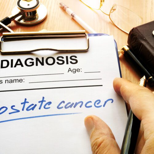 Anxiety Over Prostate Cancer Diagnosis Can Lead To Overtreatment