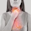 Acid Reflux Drugs PPIs Use Raises Stomach Cancer Risk