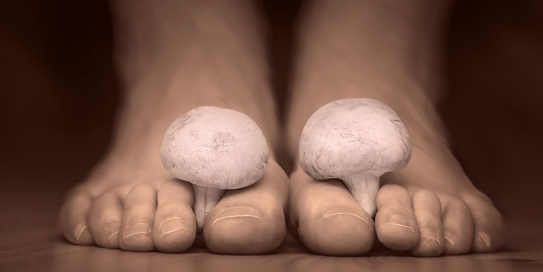 Yeast Infection And Toenail Fungus Medicines What You Should Know Medshadow