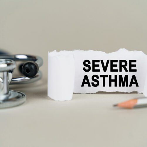 Antibiotics For Severe Asthma: Are They Really Necessary?