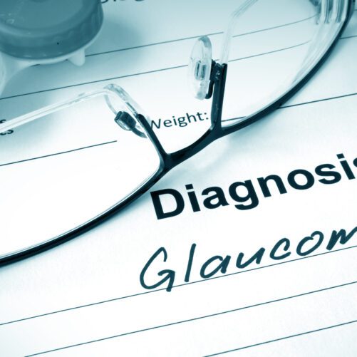 Glaucoma: 3 Ways To Treat A Sneaky Disease