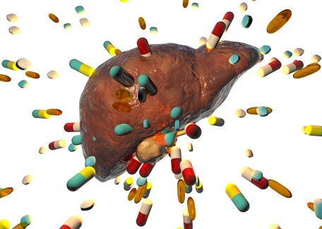 5 Common Meds That Cause Liver Damage