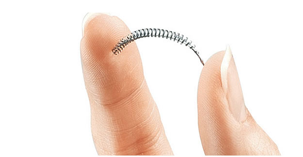 Patient Power: Thwarting Sales of Essure ... A Dangerous Device