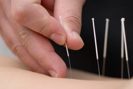 Acupuncture: Fast Facts