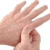 Arthritis Prevention: 5 Simple Hand Exercises