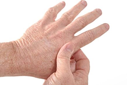 Arthritis Prevention: 5 Simple Hand Exercises