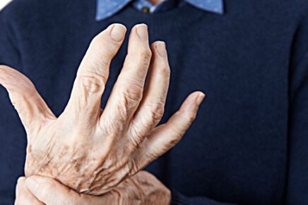 Dealing With Side Effects of Arthritis Medications
