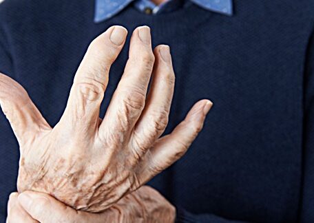 Dealing With Side Effects of Arthritis Medications