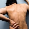 Steroids No Better Than Placebo for Sciatica Pain