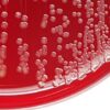Some Corticosteroids Raise Staph Infection Risk