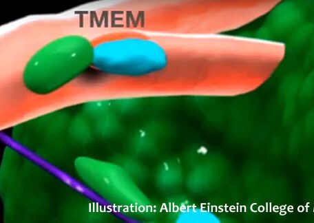 Spying on Cancer