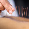 Acupuncture Is Proving Effective - Research Round Up