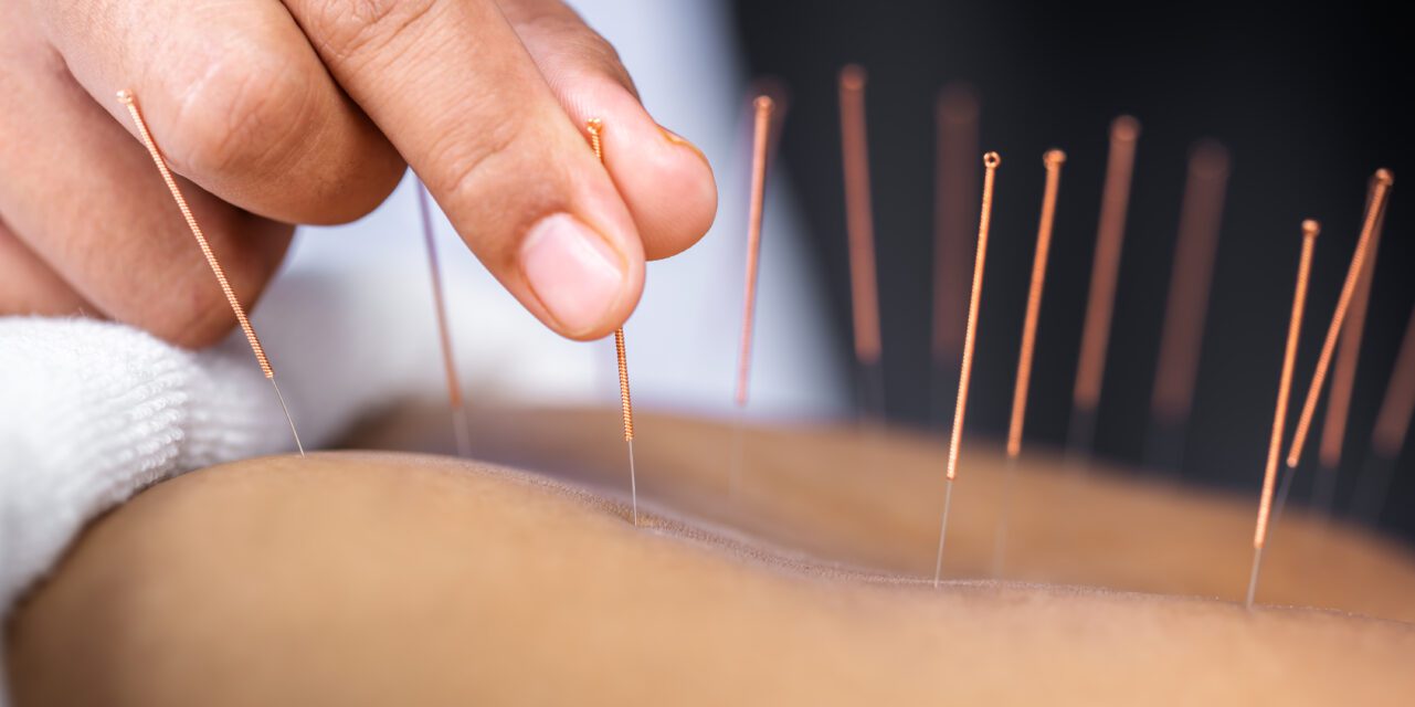 Acupuncture Is Proving Effective - Research Round Up