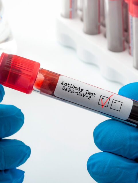 My COVID-19 Antibody Test Left Me With More Questions