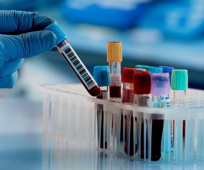 Can Convalescent Plasma Treat COVID-19 Patients?