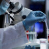 FDA Studies Antibody Tests Results