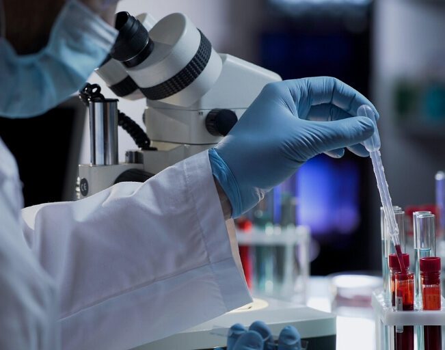 FDA Studies Antibody Tests Results