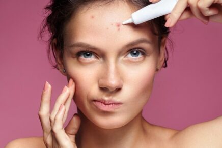 Foods to Combat Acne: What to Eat to Prevent Pimples