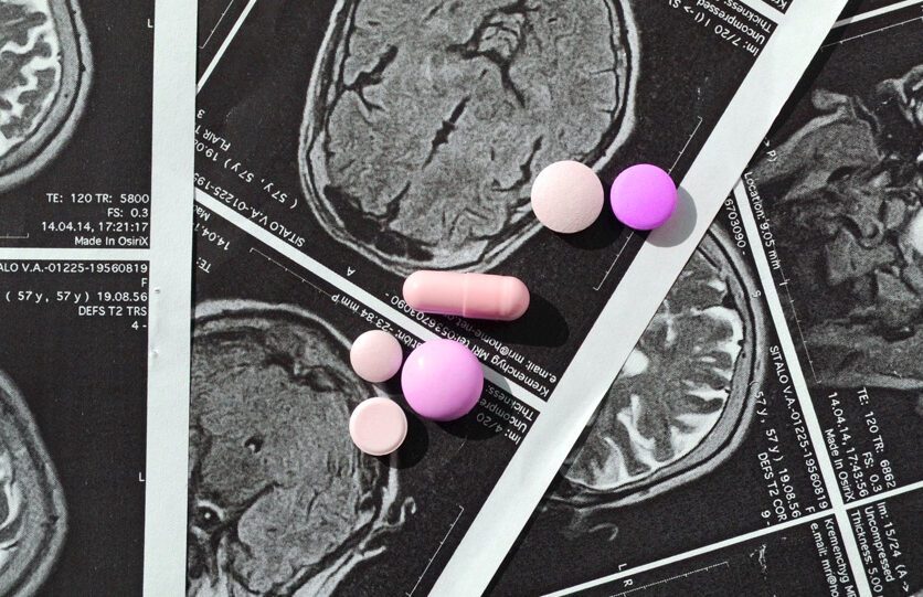 Side Effects of Anti-Epileptic Drugs: What You Should Know
