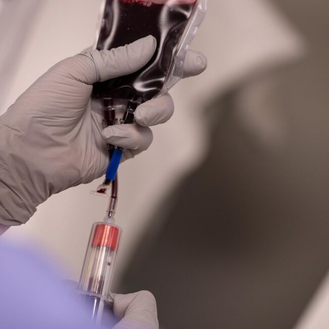 Convalescent Plasma's Role: Treating COVID-19 with Antibodies