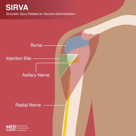 About Shoulder Pain Post-Vaccination: When Do I Need To See A Doctor ...