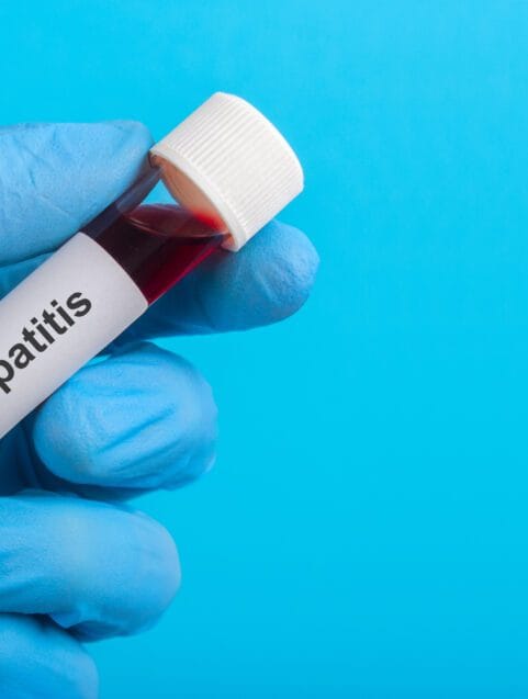 Hepatitis: Many Causes, Cures, And Side Effects