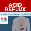 acid reflux: the causes, the symptoms, and the side effects