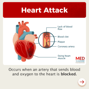 Infographic of Heart Attack | Graphic showing: lack of mood flow, blood clot, plaque, coronary artery, dying heart muscle. Explanation that says: "Occurs when an artery that sends blood and oxygen to the heart is blocked"