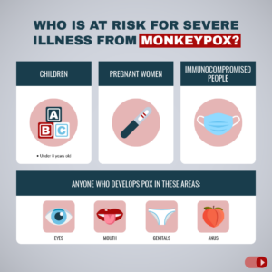 Risk for severe Moneypox