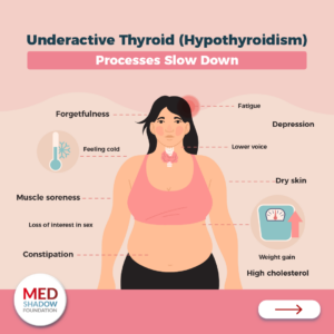Underactive Thyroid Hypothyroidism Forgetfulness Feeling cold Constipation Muscle soreness Loss of interest in sex Dry skin Depression Fatigue Lower voice Weight gain High cholesterol