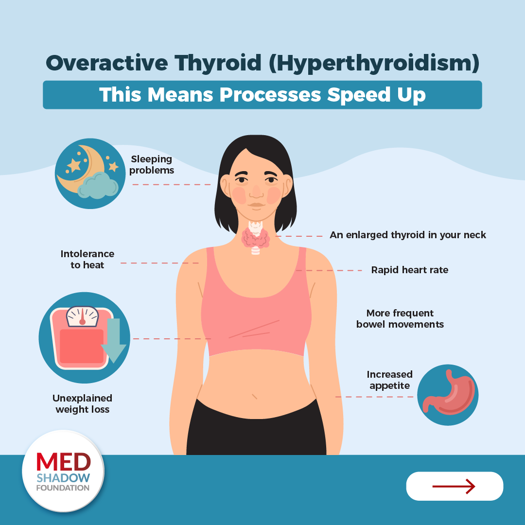 Symptoms of an Under Active Thyroid (Hypothyroidism) Sleeping problems Intolerance to heat Unexplained weight loss Rapid heart rate Enlarged thyroid Increased appetite