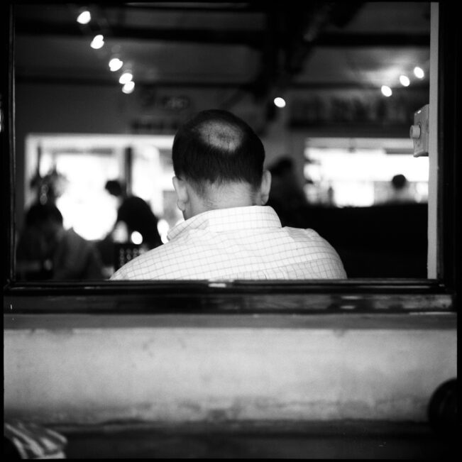 Side Effects of Propecia