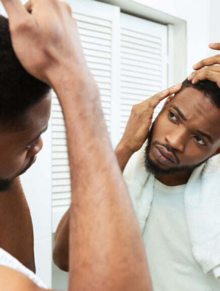 6 Drugs That Cause Hair Loss