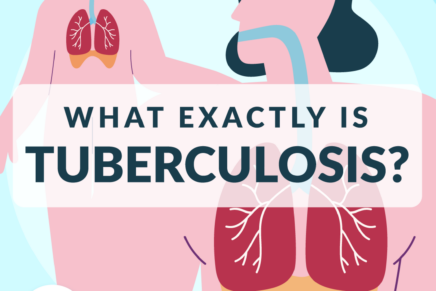 Tuberculosis Carousel Infographic