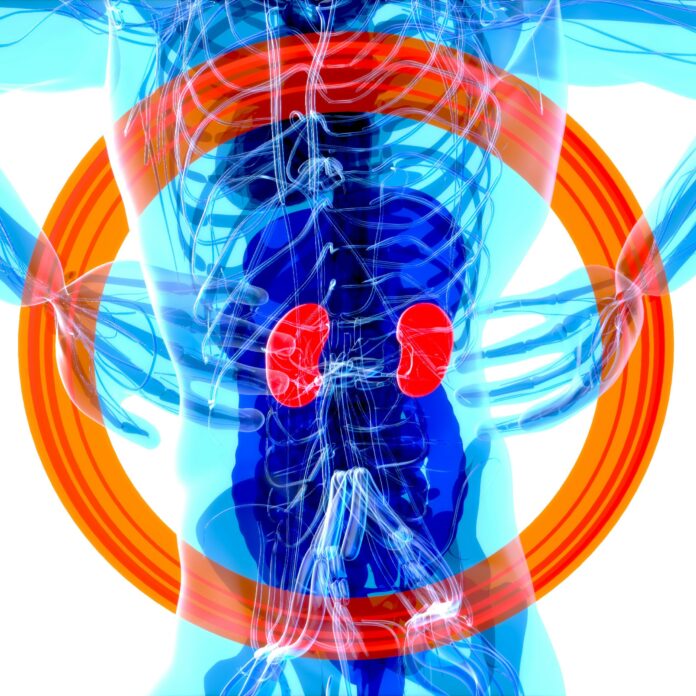 6 Drugs That Can Cause Kidney Damage