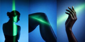 acupuncture and arthritis